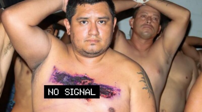 Pandillero intentó borrar sus tatuajes quemándoselos pero PNC ya lo tenía perfilado desde antes.