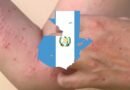 Ministerio de Salud de Guatemala reporta primer caso de viruela de mono en su país.